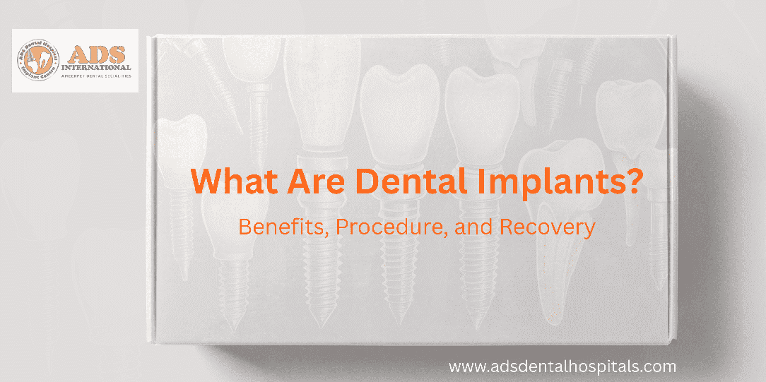 Understanding Dental Implants: Benefits and Recovery.