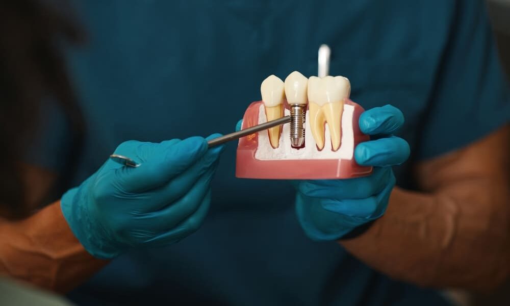 dental implants journey