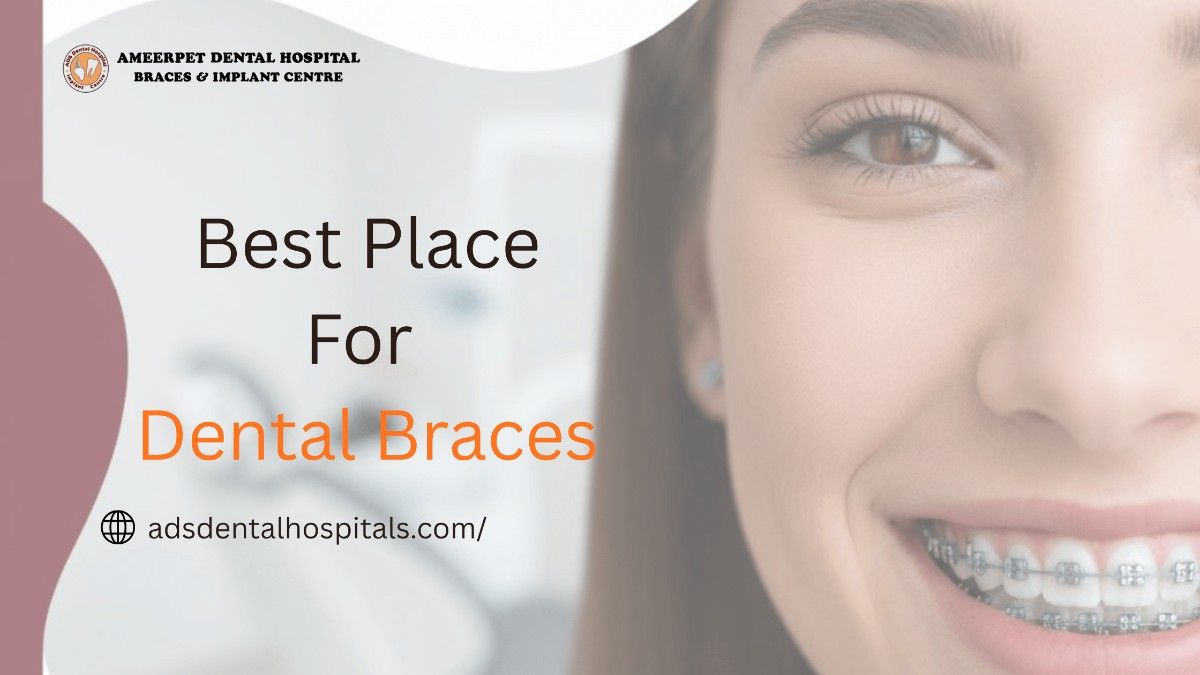 Which is the Best Place for Dental Braces Treatment in Hyderabad? (2025 Guide)