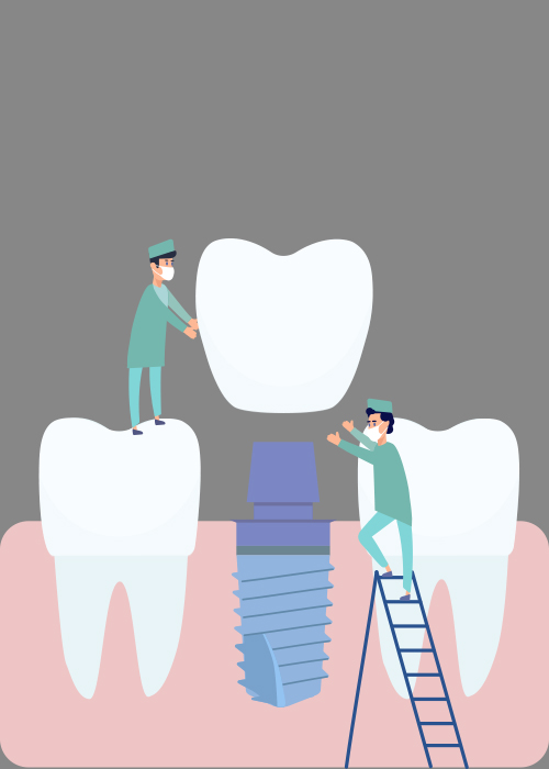 dental implants in gachibowli