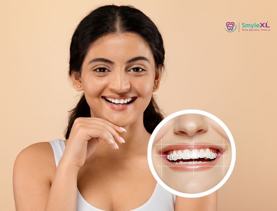Smile Designing and ceramic laminates at ADS Dental Hospitals Hyderabad