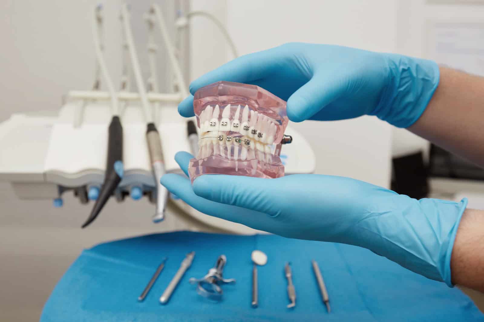 Orthodontics and braces at ADS Dental Hospital Hyderabad — Ameerpet and Gachibowli