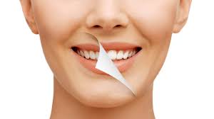Smile Designing in Hyderabad — ADS Dental Hospital